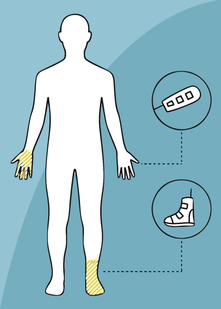 Polyneuropathie Menschliche Silhouette mit hervorgehobenen Händen und Füßen sowie Symbolen für Zubehör.